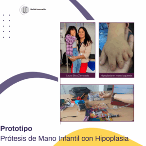 Prótesis de Mano Infantil con Hipoplasia